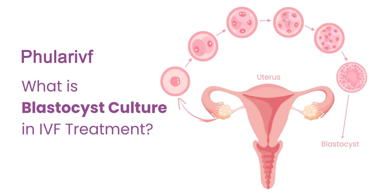 Blastocyst Culture and Transfer at Phular IVF Hospital