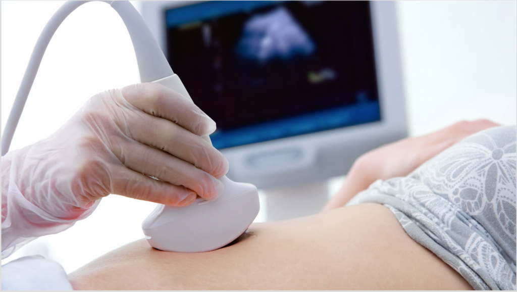 Sonography